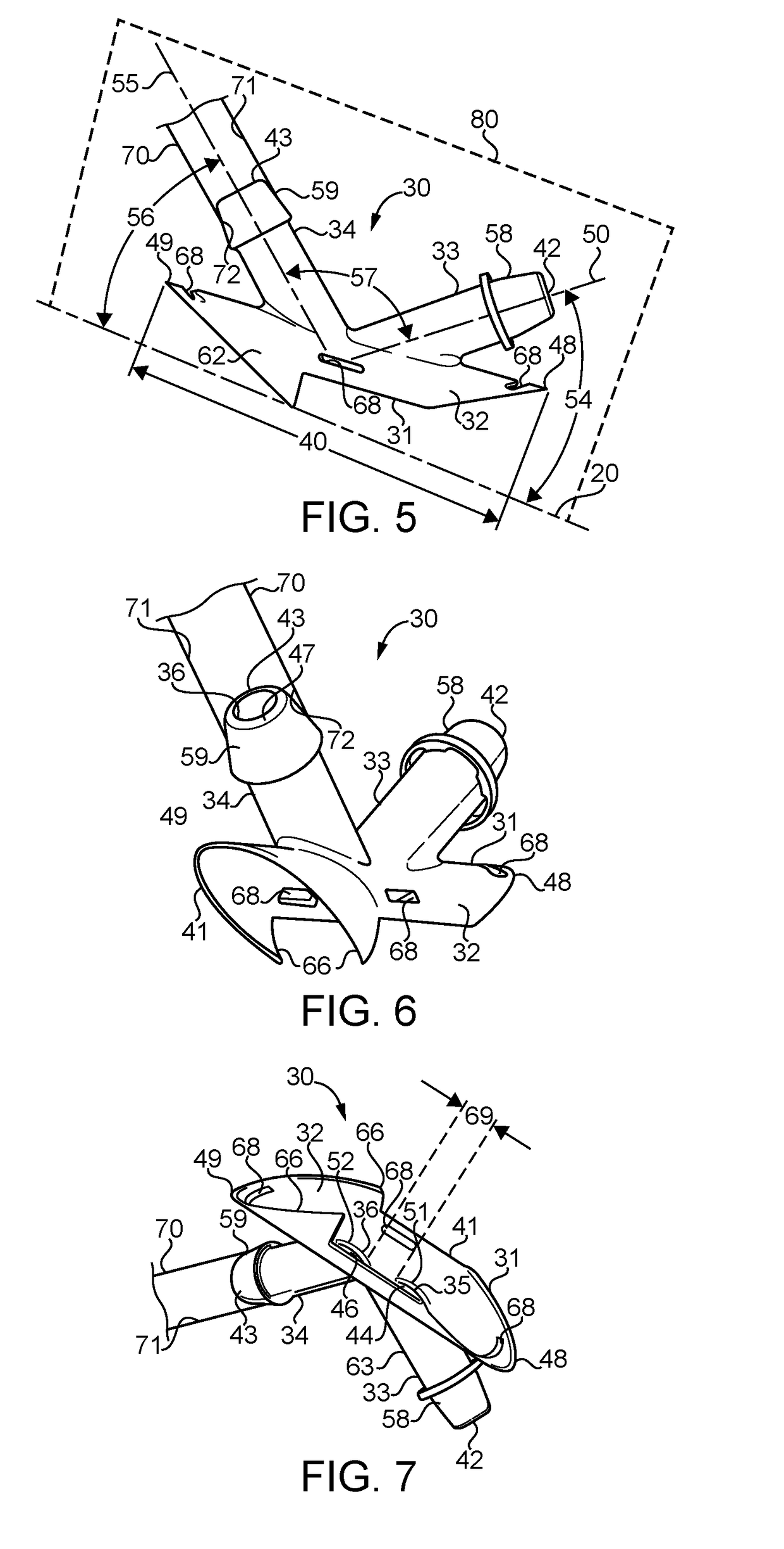 Combined arterial venous fistula graft implant and method of using same