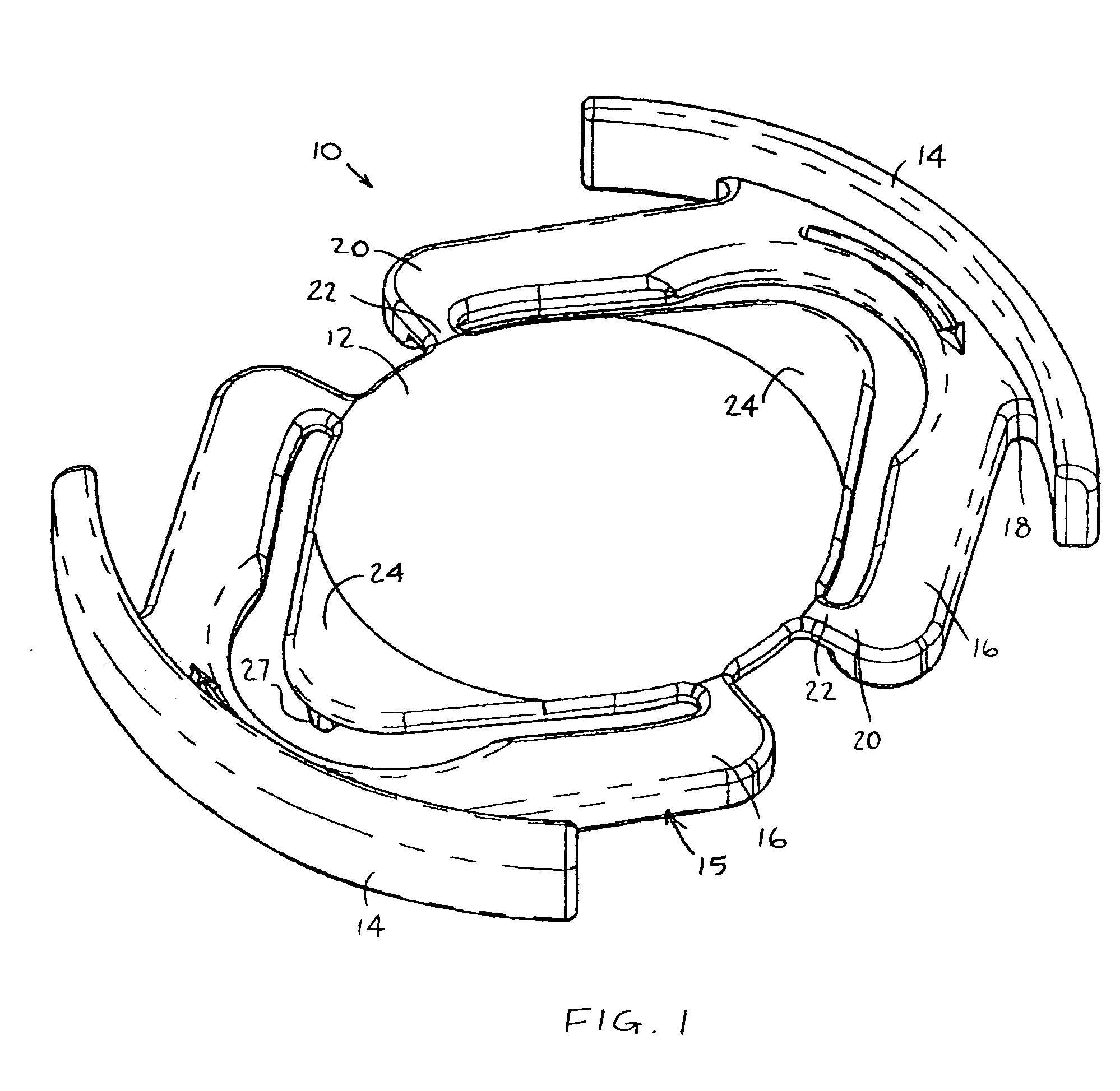 Prevention of dislocation of an IOL