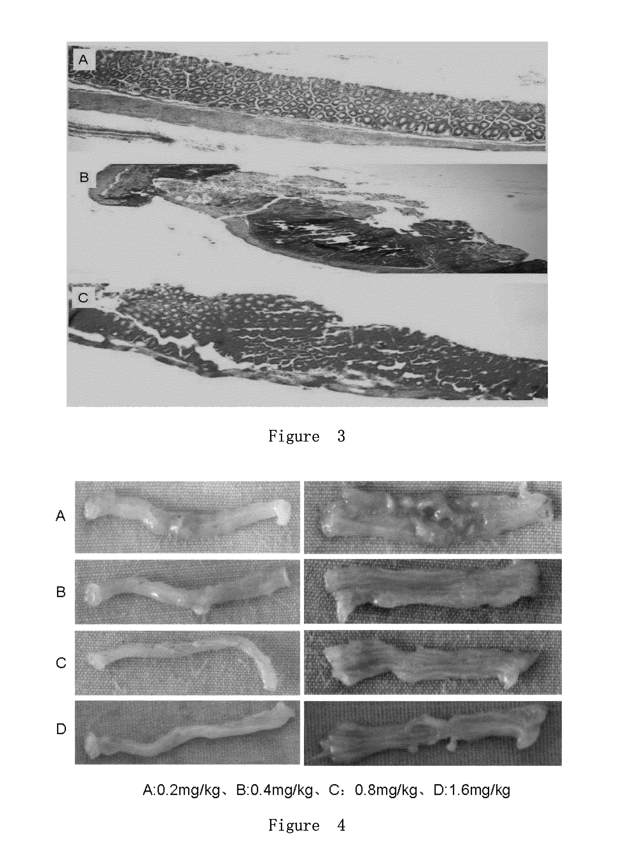 Use of <i>salmonella </i>flagellin derivative in preparation of drug for preventing and treating inflammatory bowel diseases