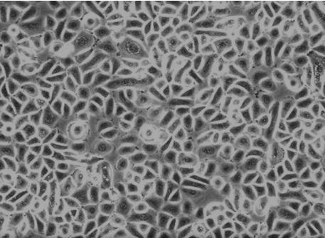 Serum-free complete culture medium for inducing mesenchymal stem cells to be differentiated into corneal epithelial cells