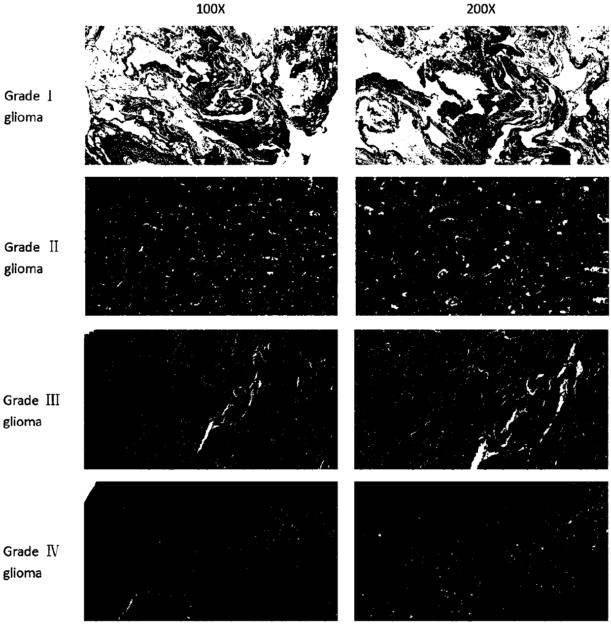 Application of RDH10 (retinol dehydrogenase 10) gene to preparation of TWEAK-NF-kappaB signal pathway blocking agent