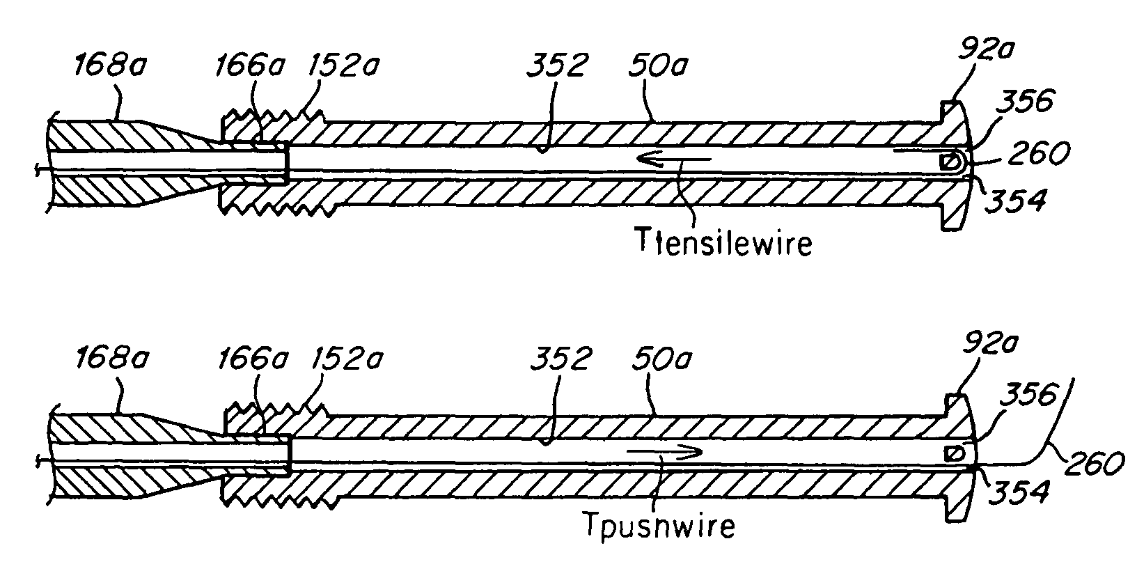 Screw catch mechanism for PFO occluder and method of use