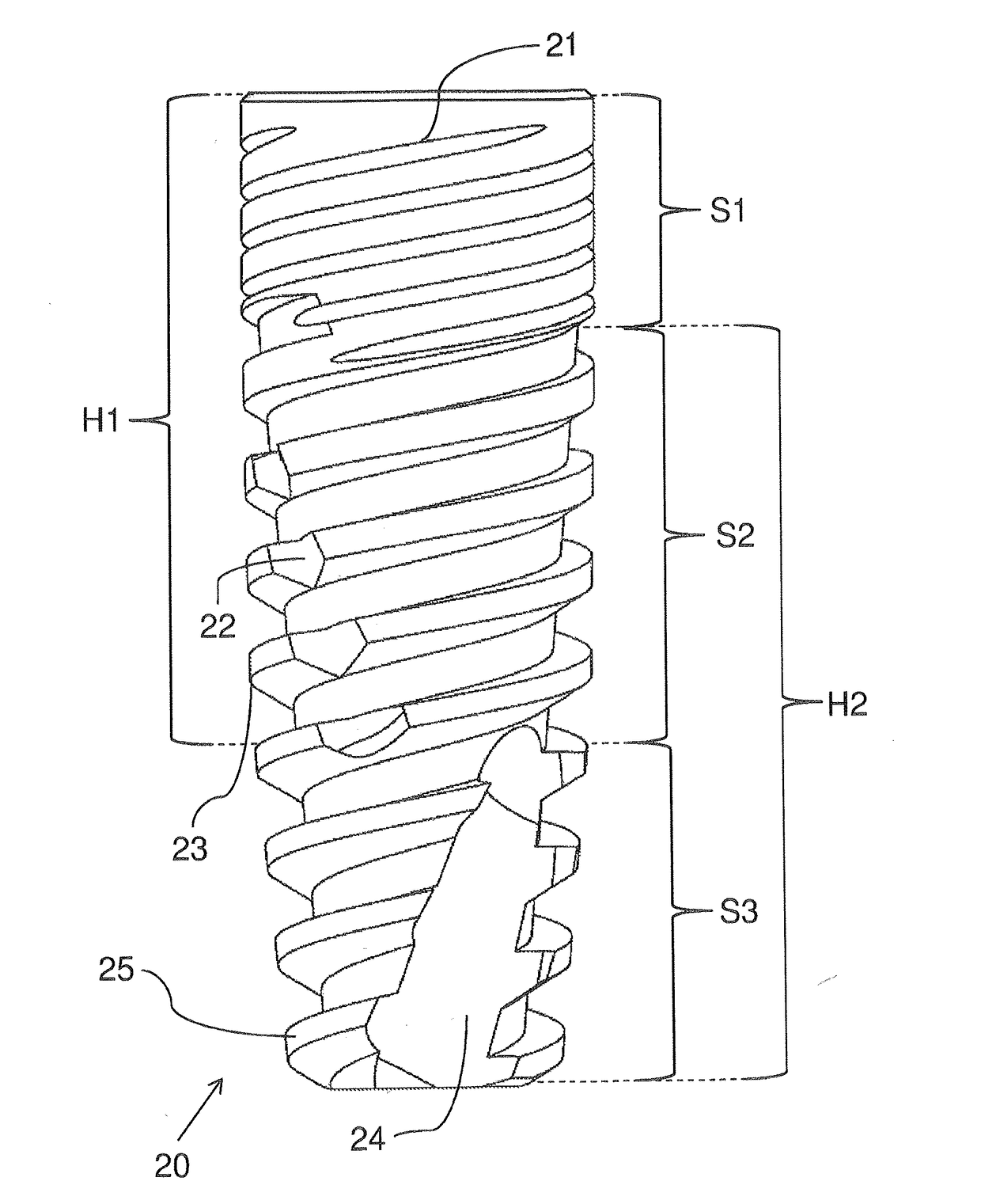 Dental implants having golden ratio