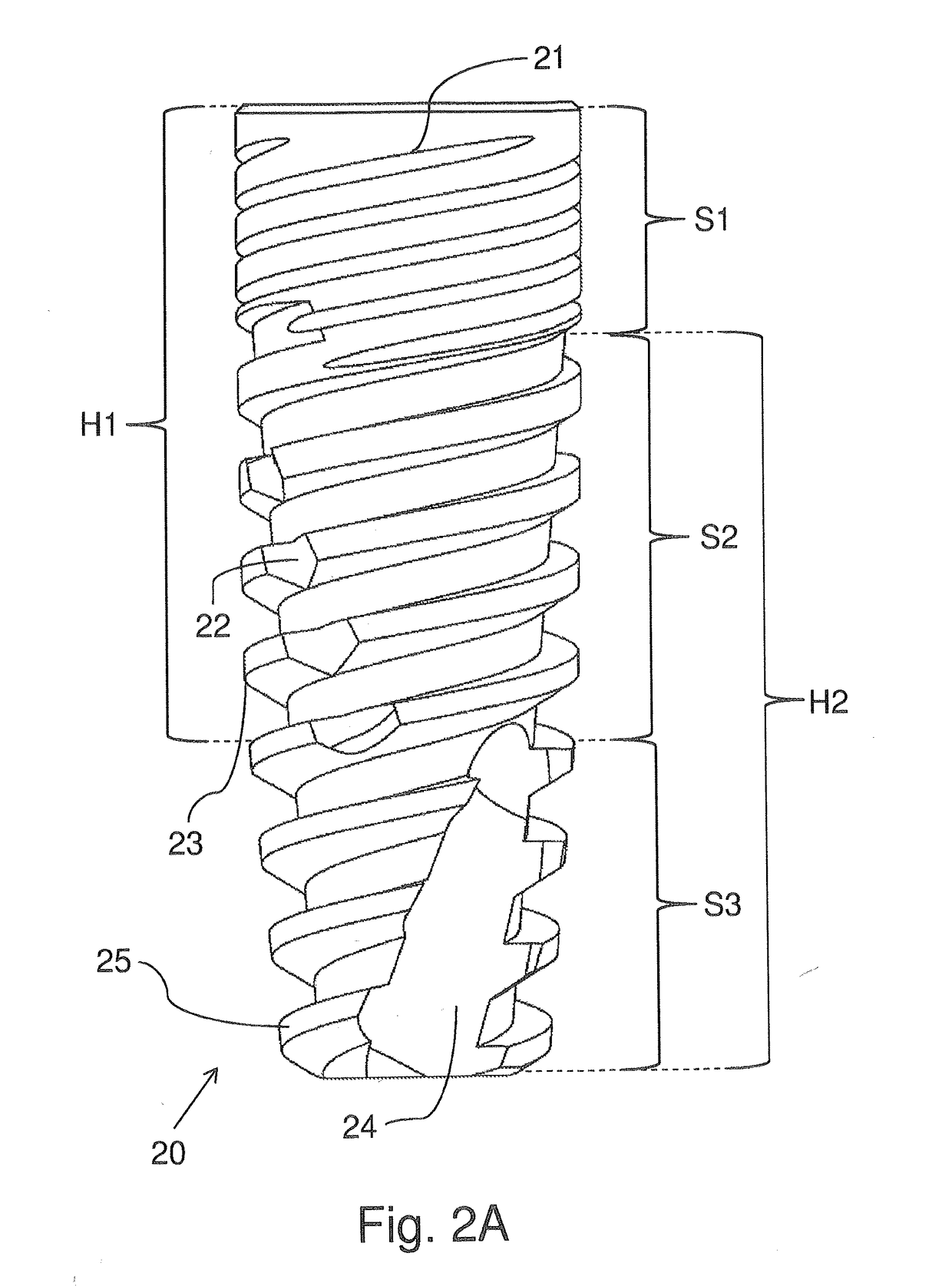 Dental implants having golden ratio