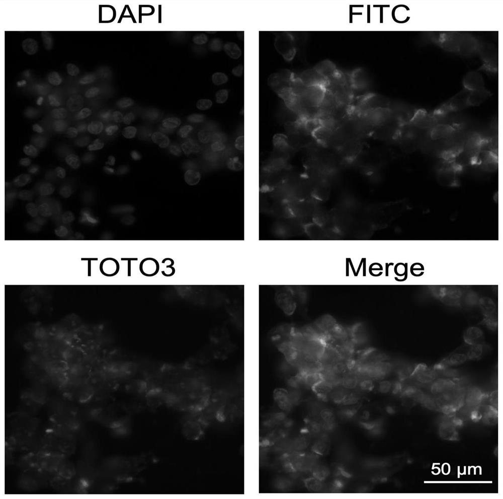 Preparation method and application of protein-polymer composite nanomaterial gene vector