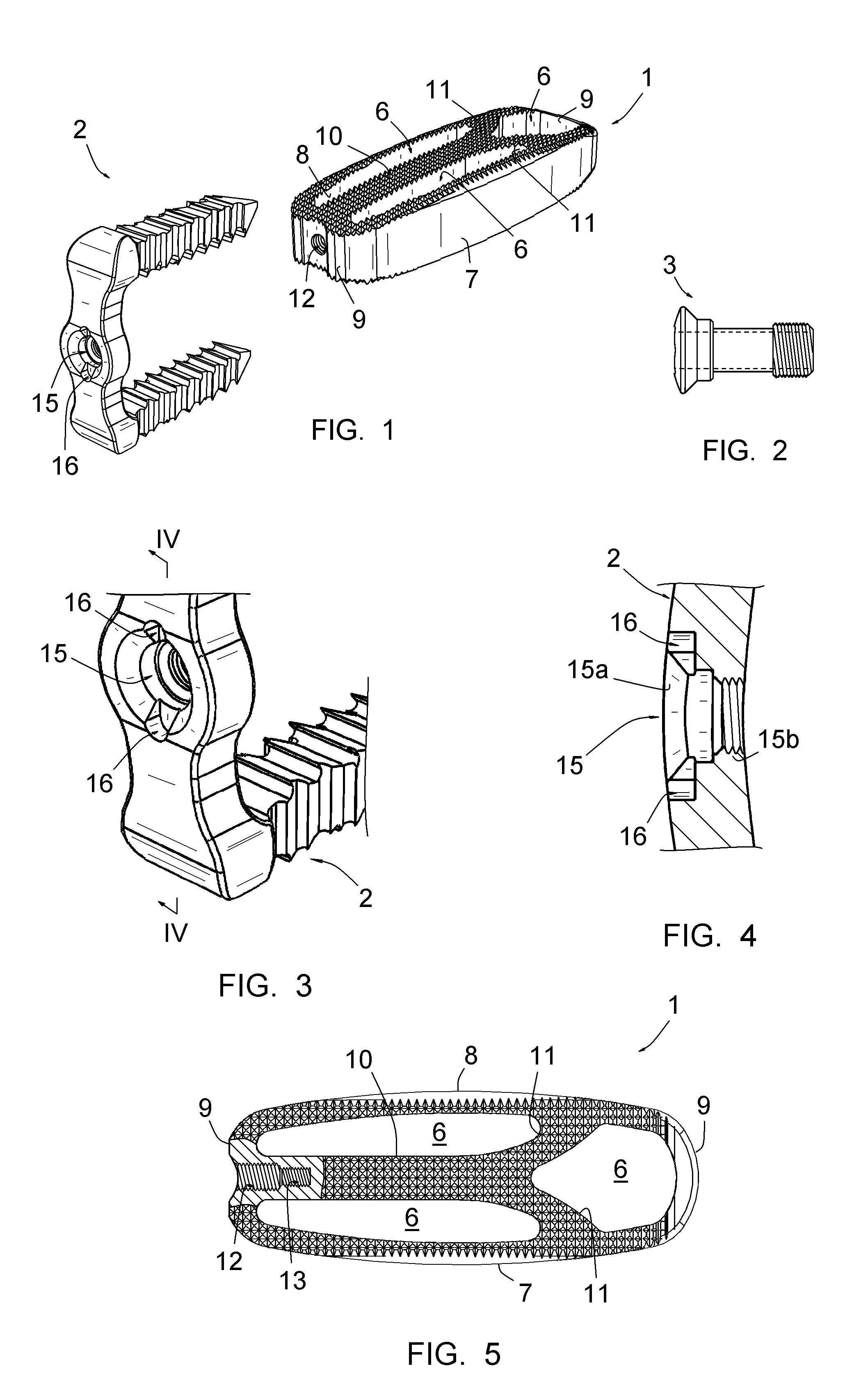 Vertebral osteosynthetis equipment