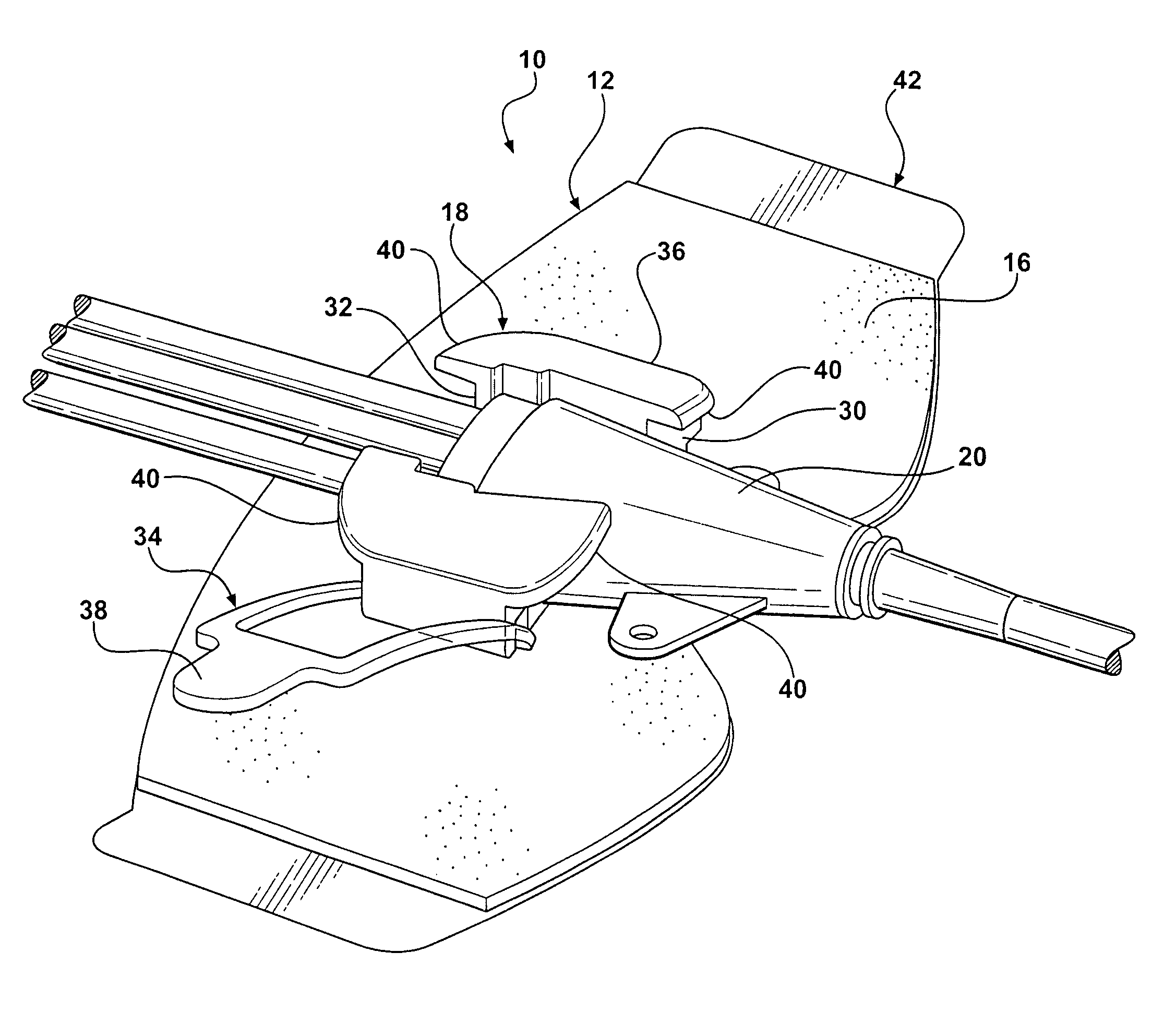 Catheter securement device