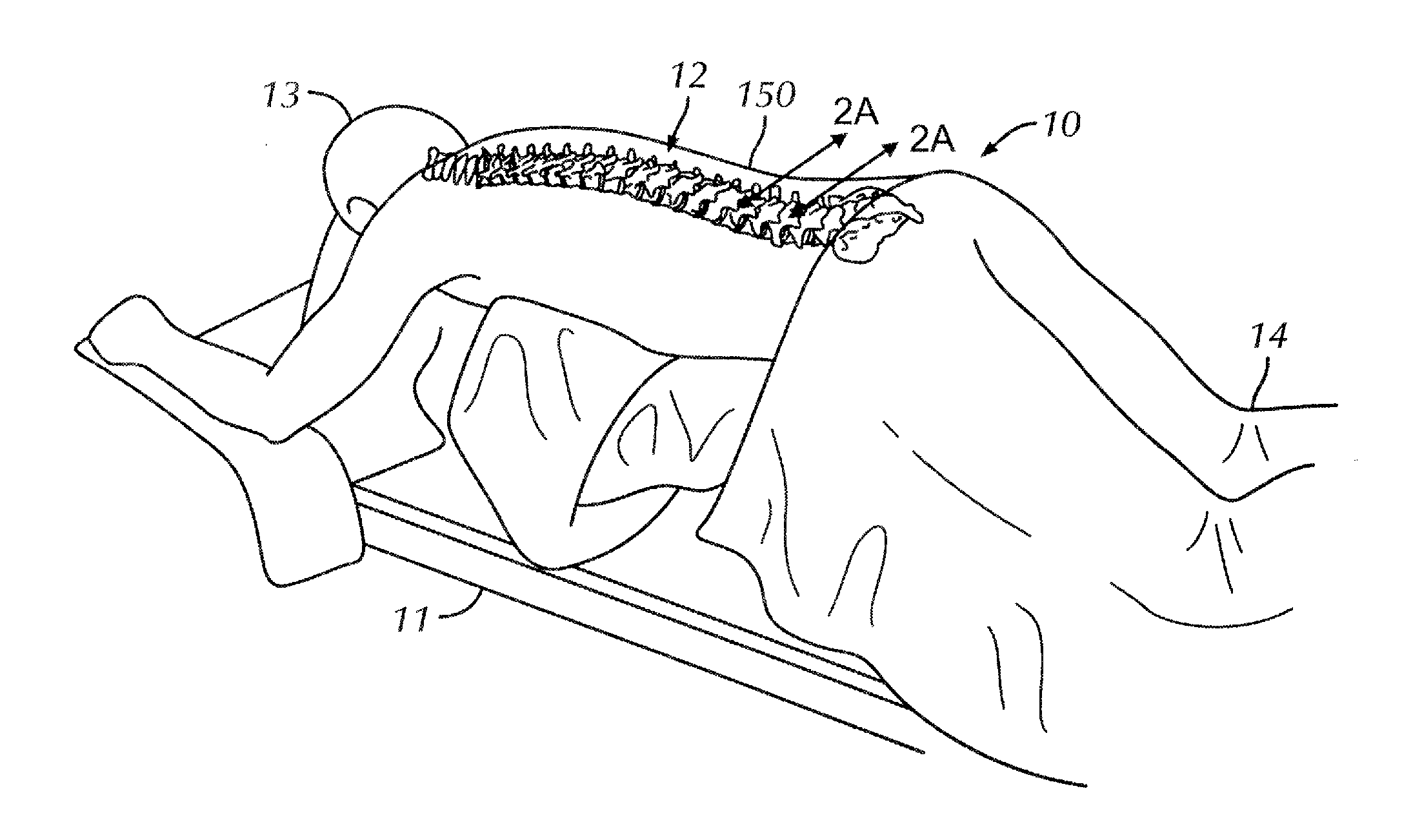 Surgical instrument system and method for providing retraction and vertebral distraction