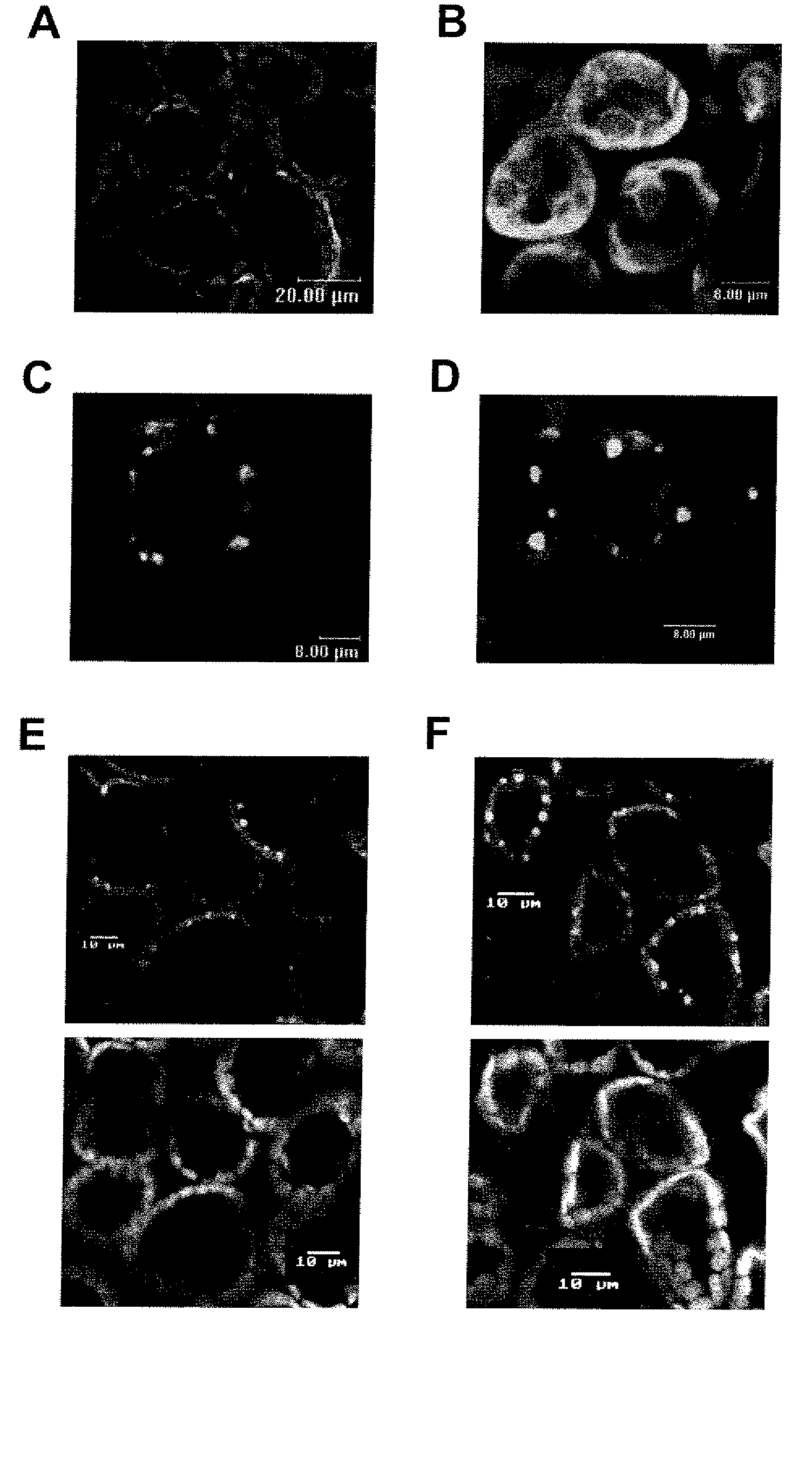 Hrpn interactors and uses thereof