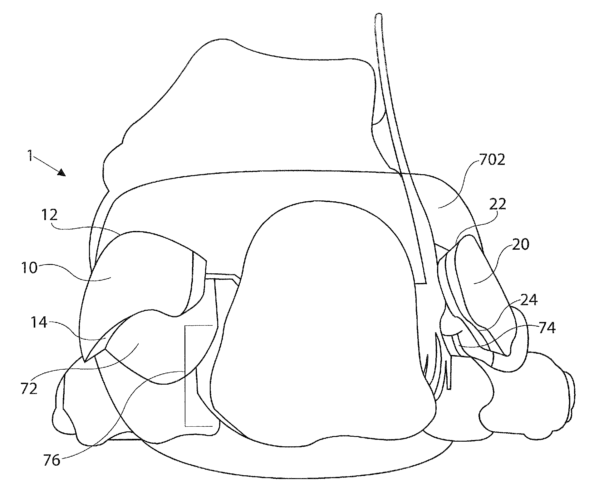 Heel stabilizer for footwear