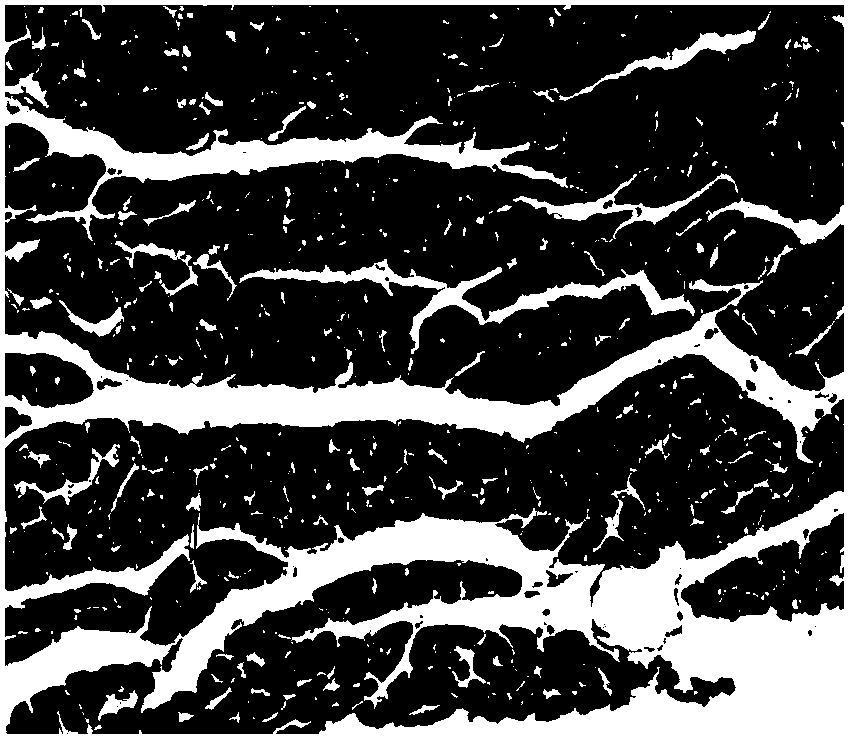 Method for preparing medicine with areca-nut component and anti-hypoxic application of medicine