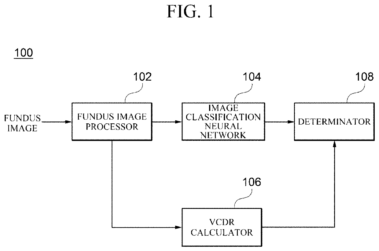 Apparatus for diagnosing glaucoma