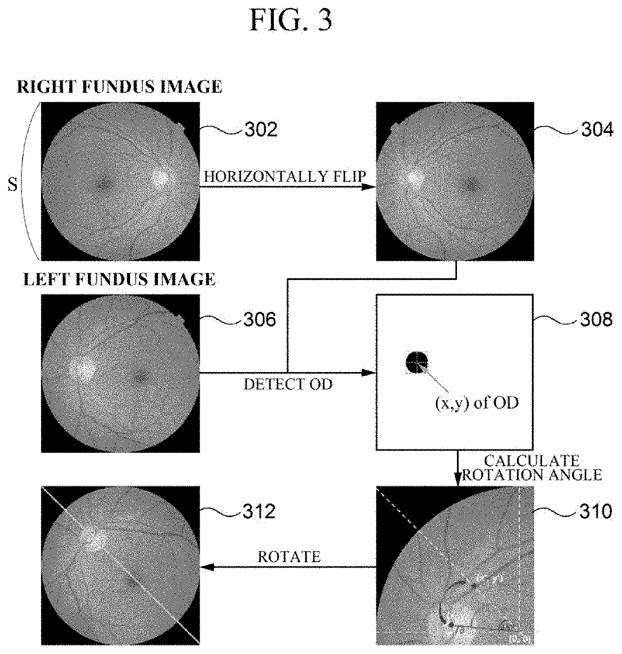 Apparatus for diagnosing glaucoma