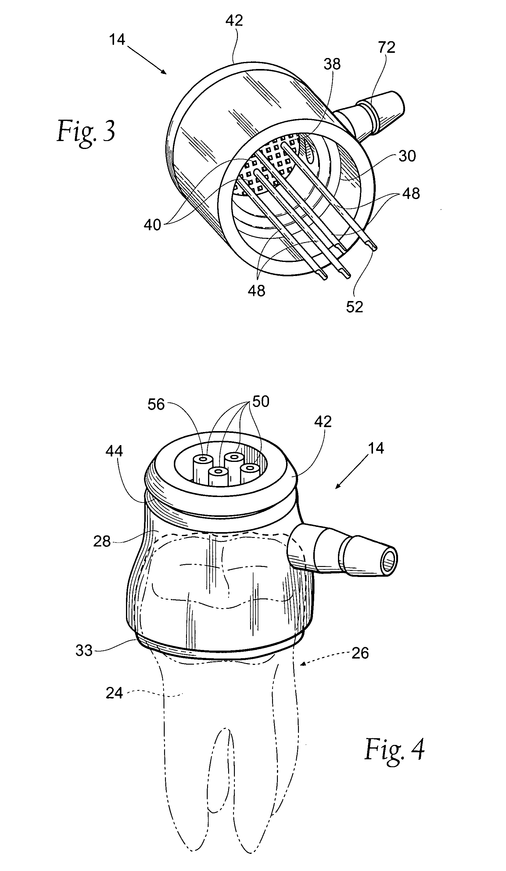 Apparatus and methods for treating tooth root canals