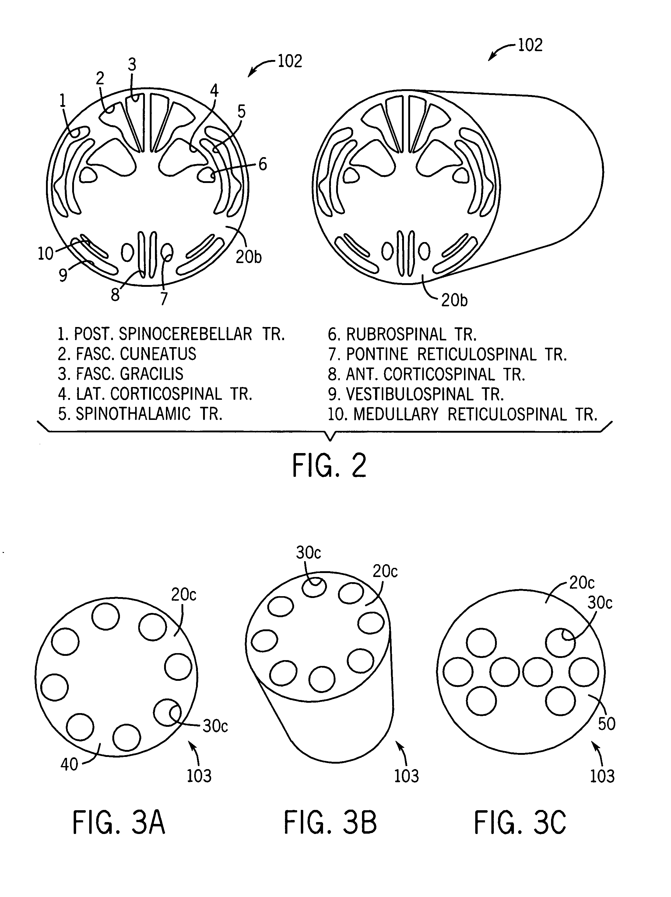 Spinal cord surgical implant