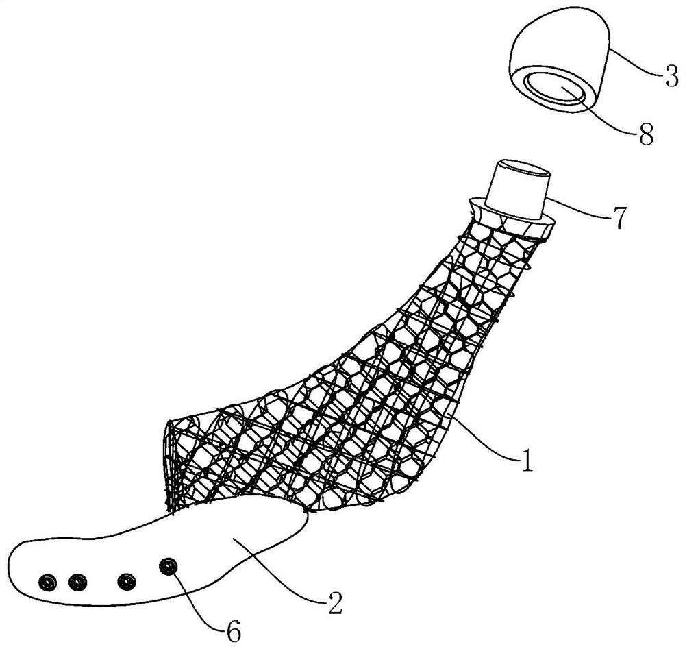 Temporomandibular joint prosthesis