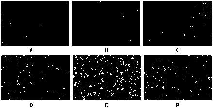 Stem cell preparation against malignant melanoma and preparation method thereof