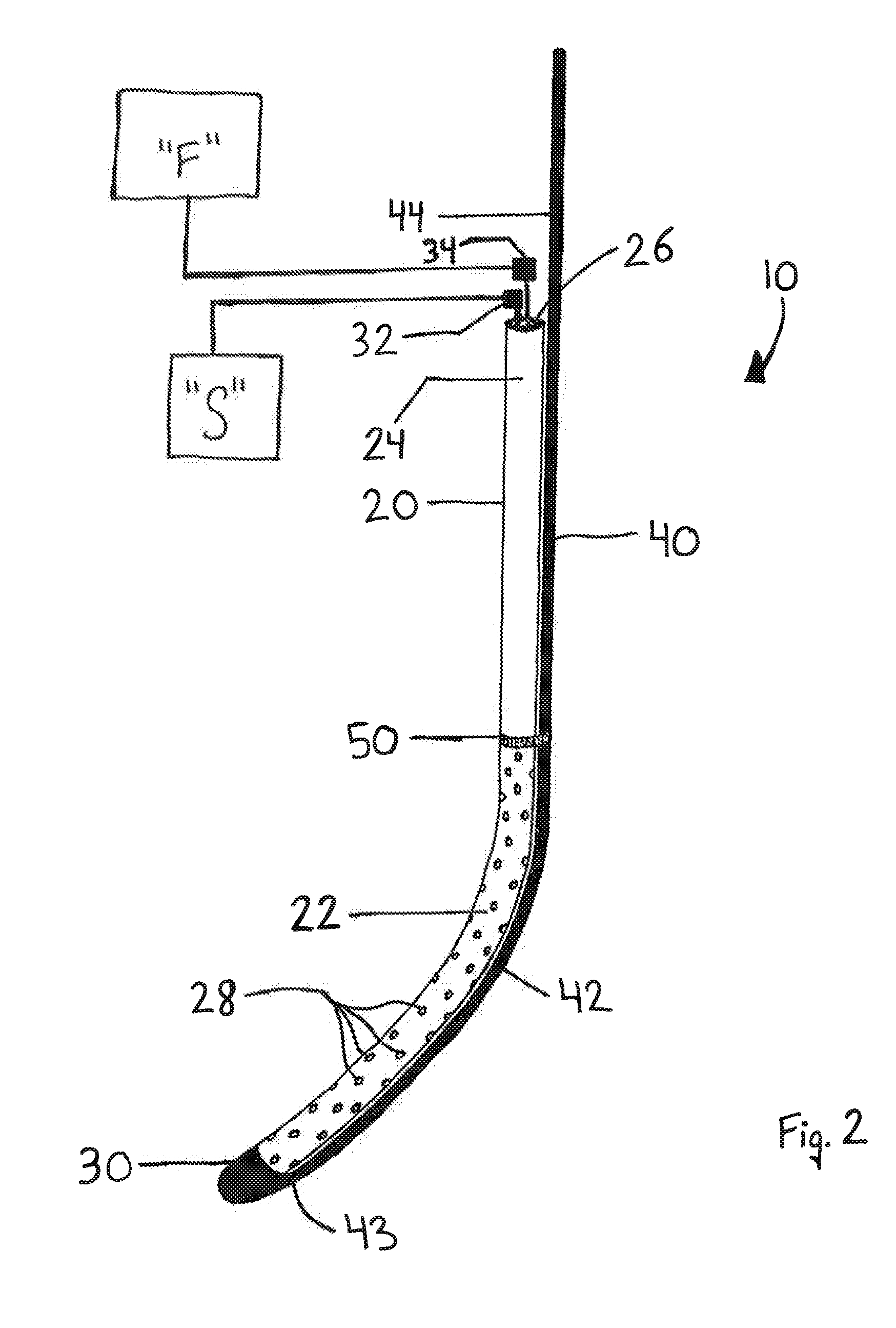 Devices and methods facilitating sleeve gastrectomy procedures