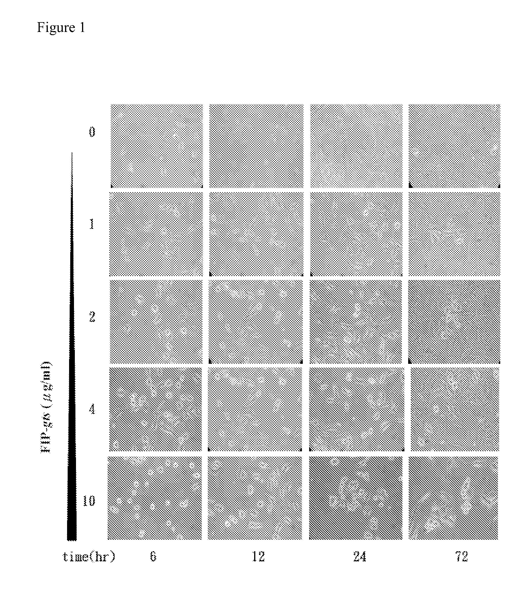 Compositions comprising fungal immunomodulatory protein and use thereof