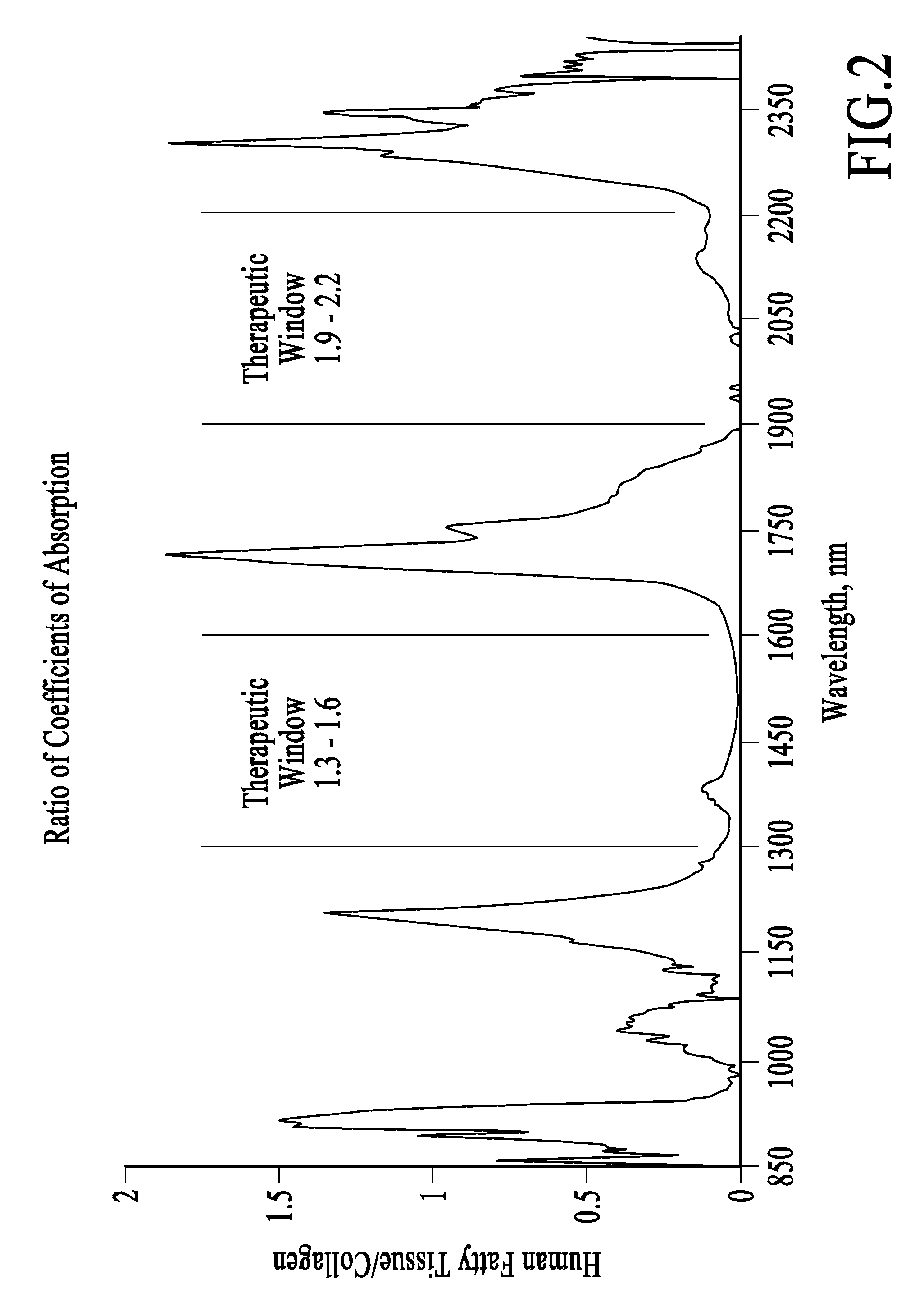 Treatment of Cellulite and Adipose Tissue with Mid-Infrared Radiation