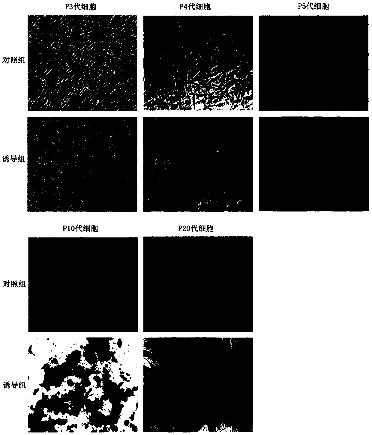 Method for simply preparing placenta mesenchymal stem cell exosome