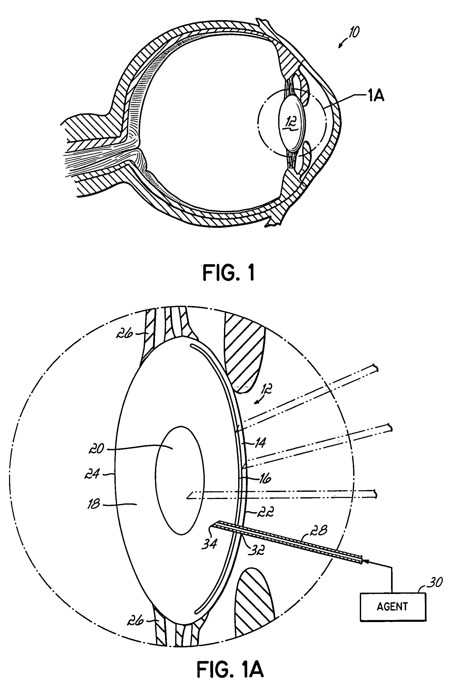 Crystalline lens drug delivery