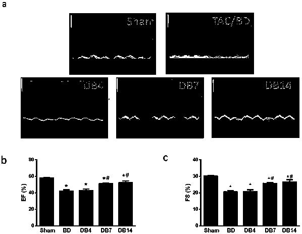 Method for constructing cardiac pressure overload/unloading mouse model