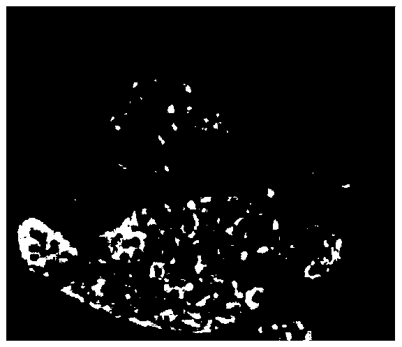 Left-atrial-appendage CT image segmentation method