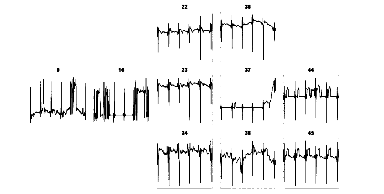 Non-invasive cardiac potential reconstruction method based on low-rank and sparse constraints and non-local total variation