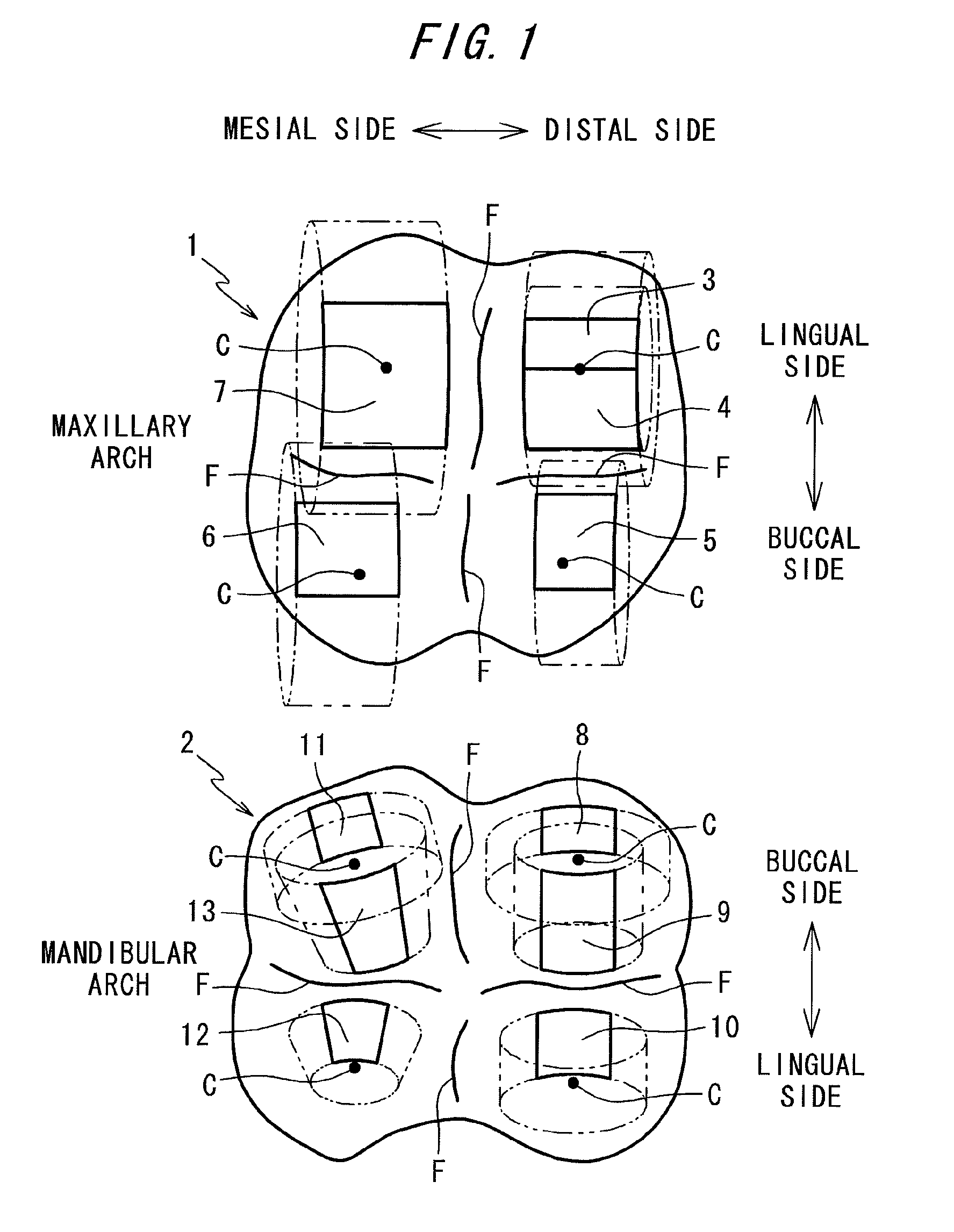 Set of artificial teeth having convex adjustment surface