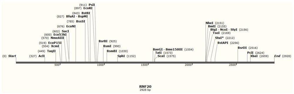 Construction of human RNF20 gene overexpression plasmid vector and effect of human RNF20 gene overexpression plasmid vector on inhibiting cancer cells