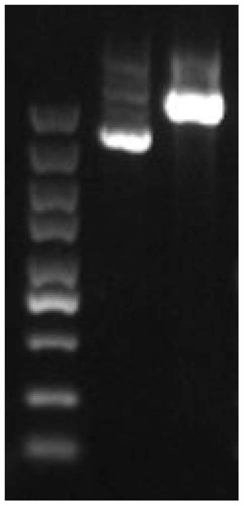 Construction of human RNF20 gene overexpression plasmid vector and effect of human RNF20 gene overexpression plasmid vector on inhibiting cancer cells