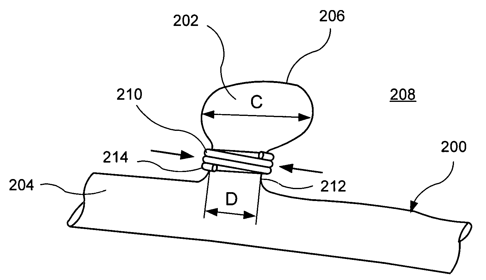 Shape memory hemostasis band