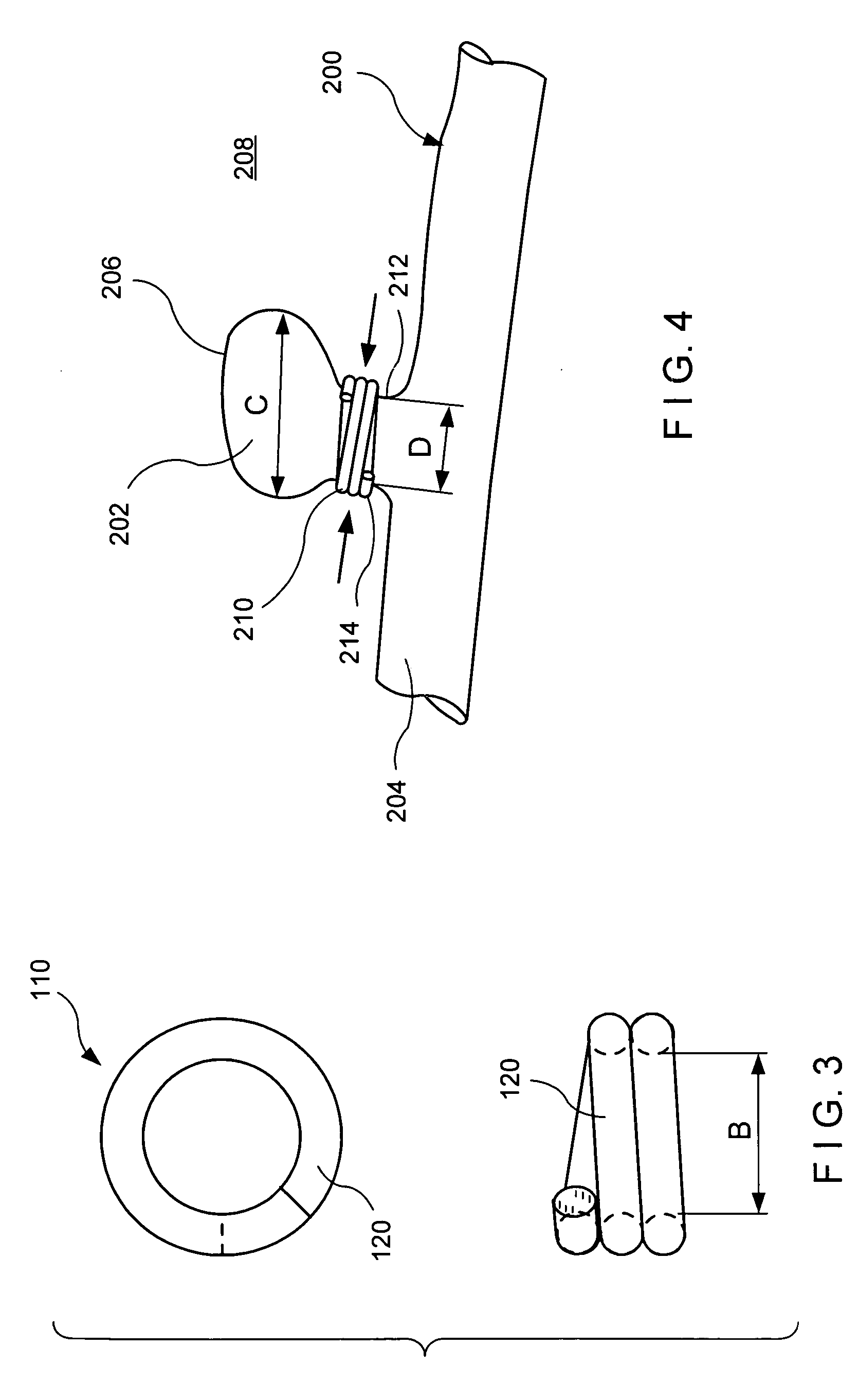 Shape memory hemostasis band