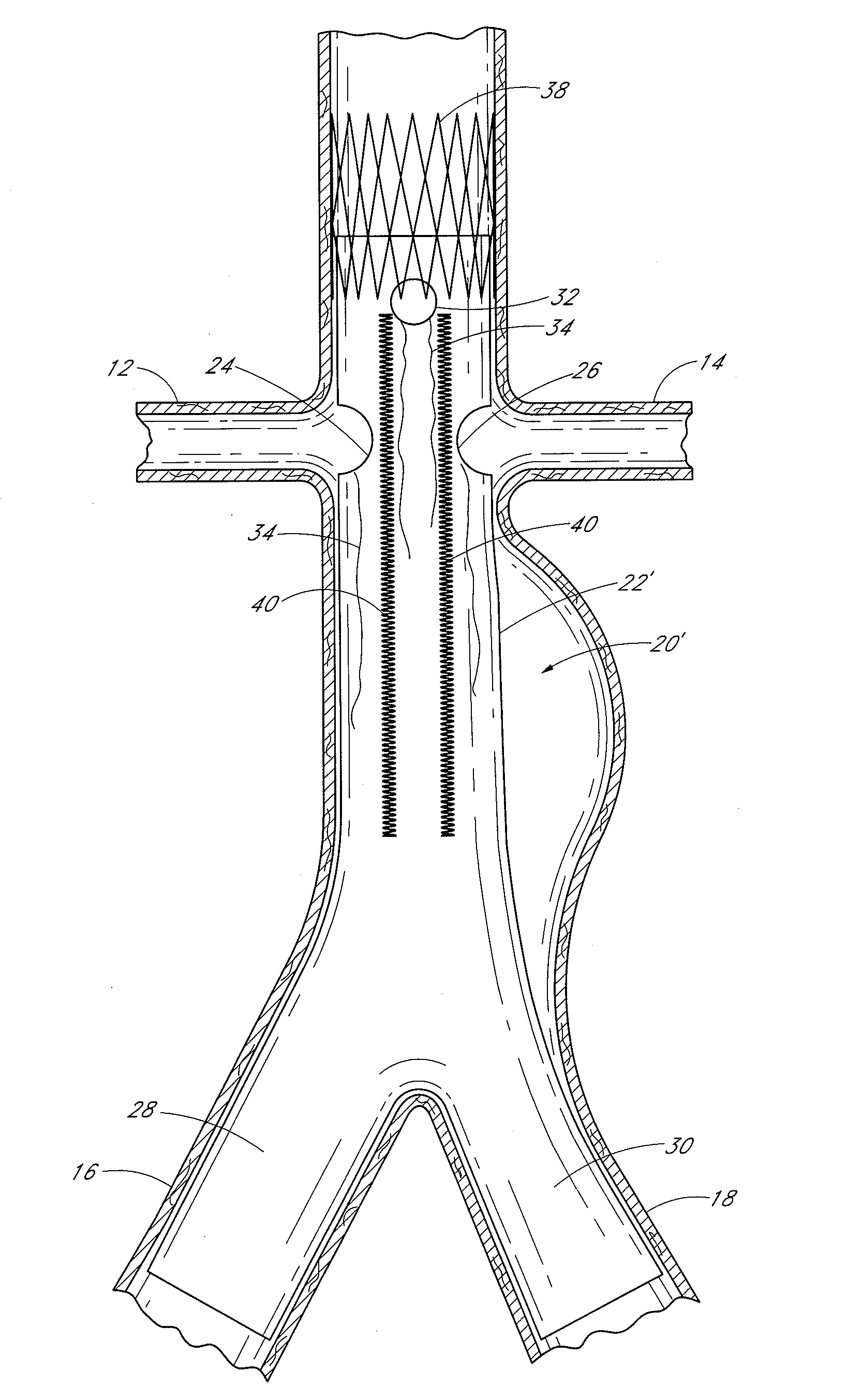 Fenestrated prosthesis