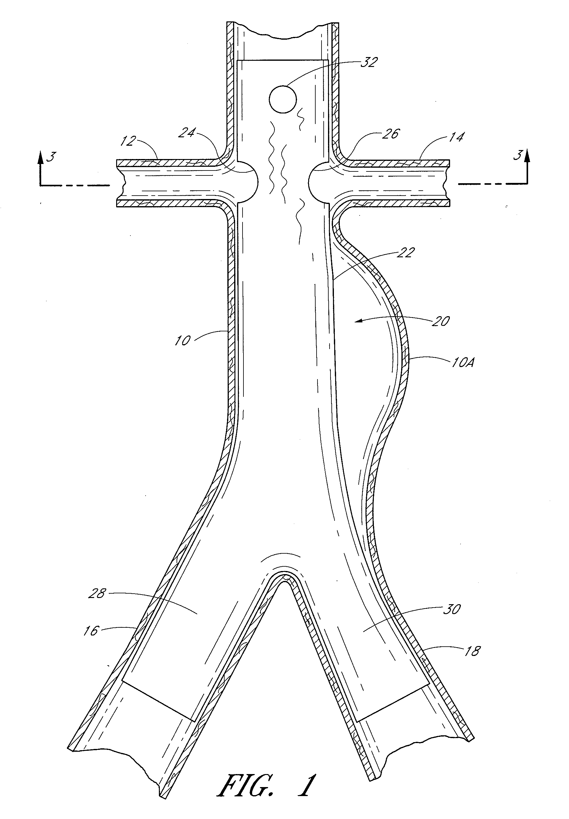 Fenestrated prosthesis