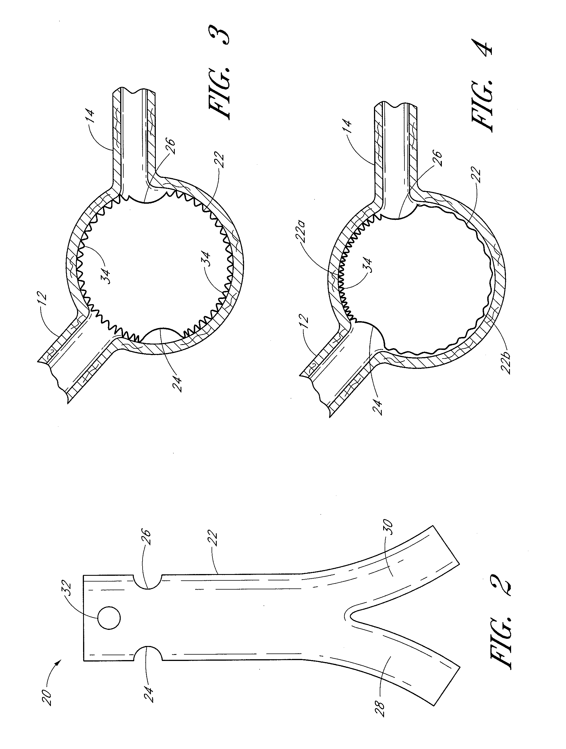 Fenestrated prosthesis