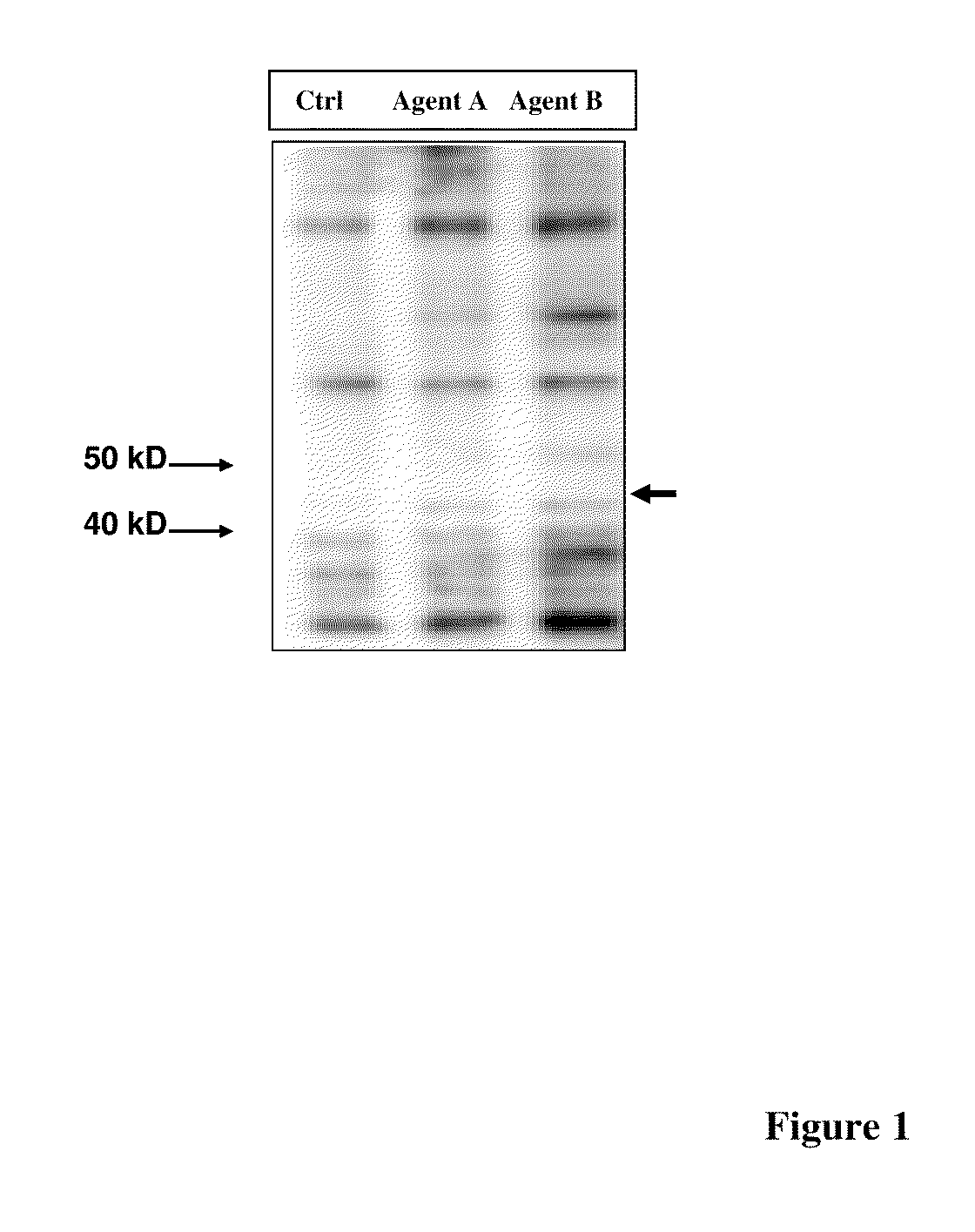 Phosphorylated NF45 Biomarkers, Antibodies And Methods Of Using Same