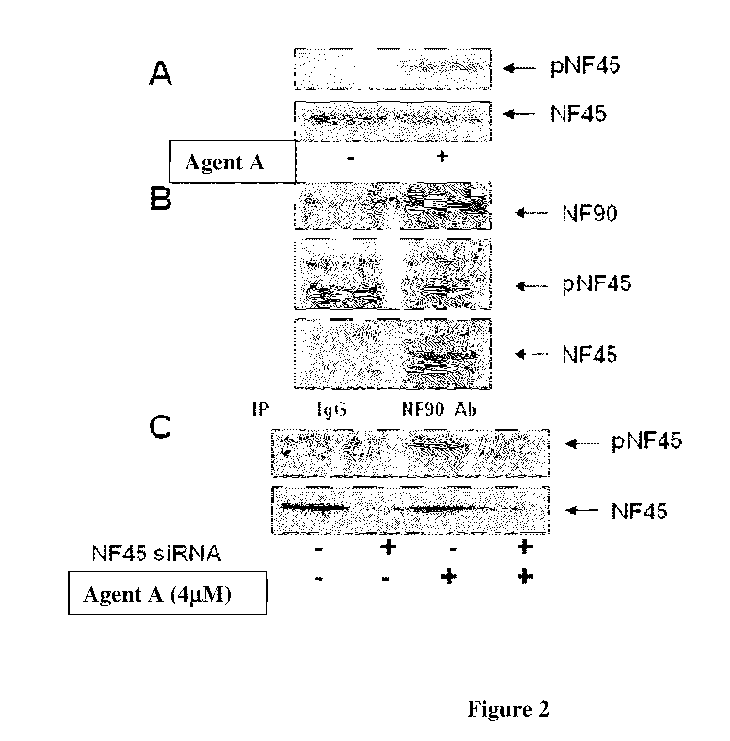 Phosphorylated NF45 Biomarkers, Antibodies And Methods Of Using Same