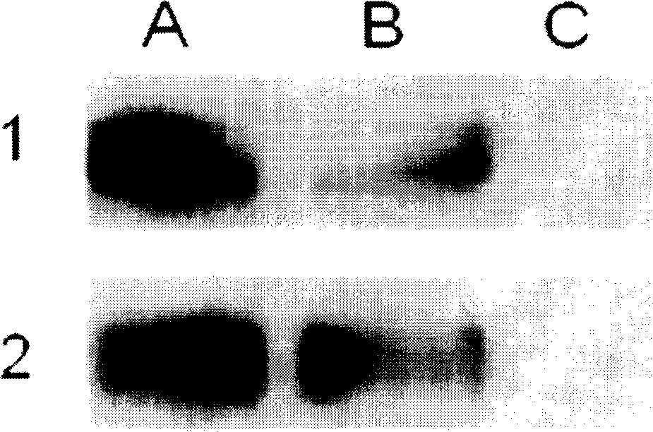 Artificial single-chain deoxynucleotide having therapeutic effect to human B cell tumour