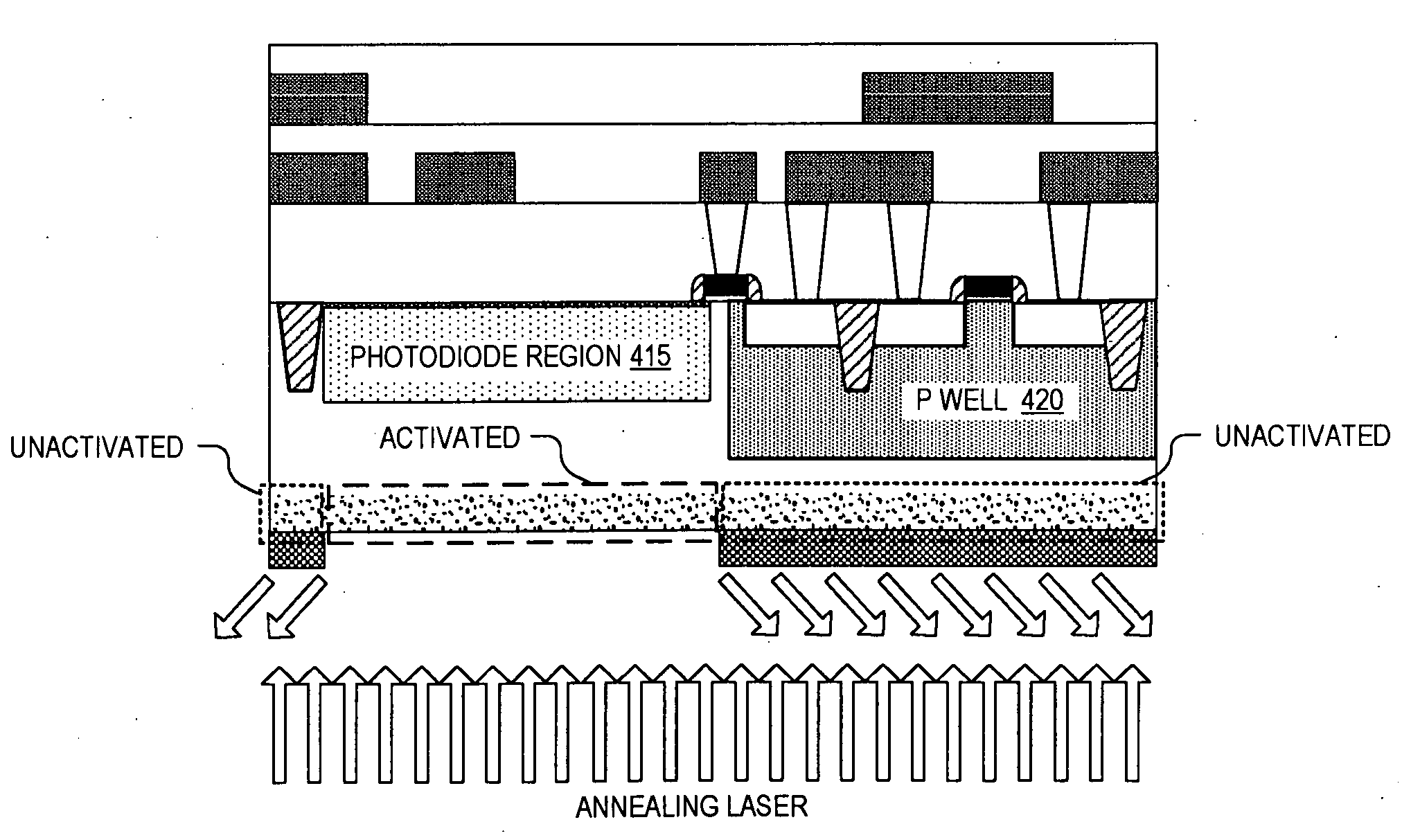 Masked laser anneal during fabrication of backside illuminated image sensors