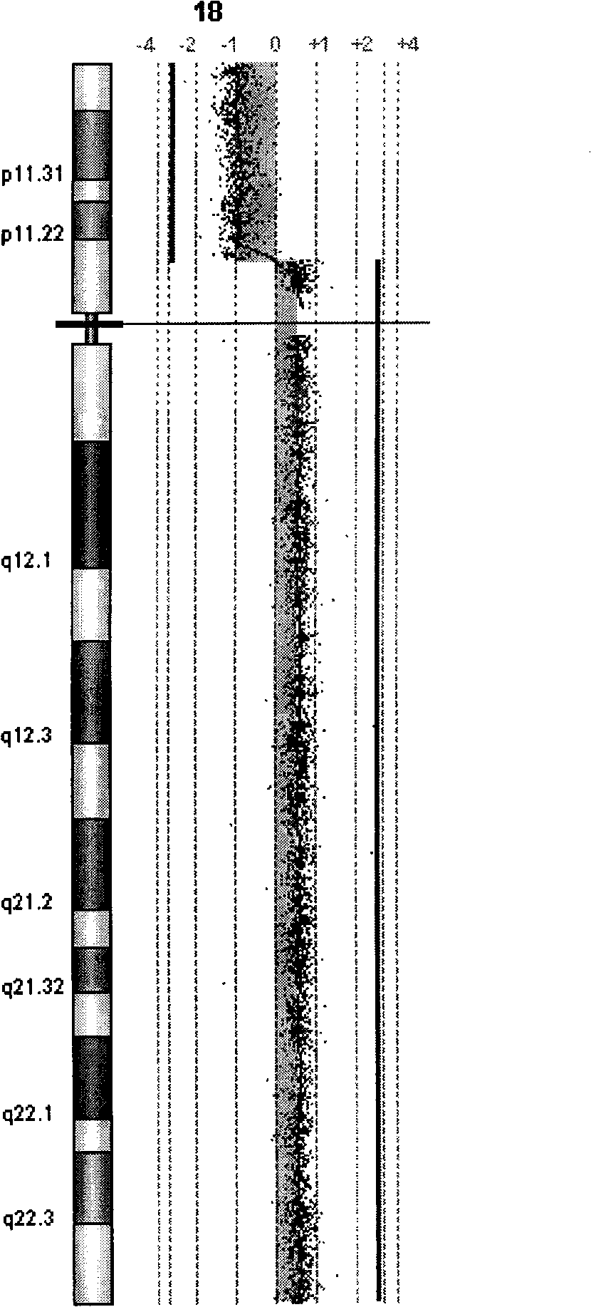 Method for preparing birth defect target oligonucleotide microarray comparative genomic hybridization hybrid chip