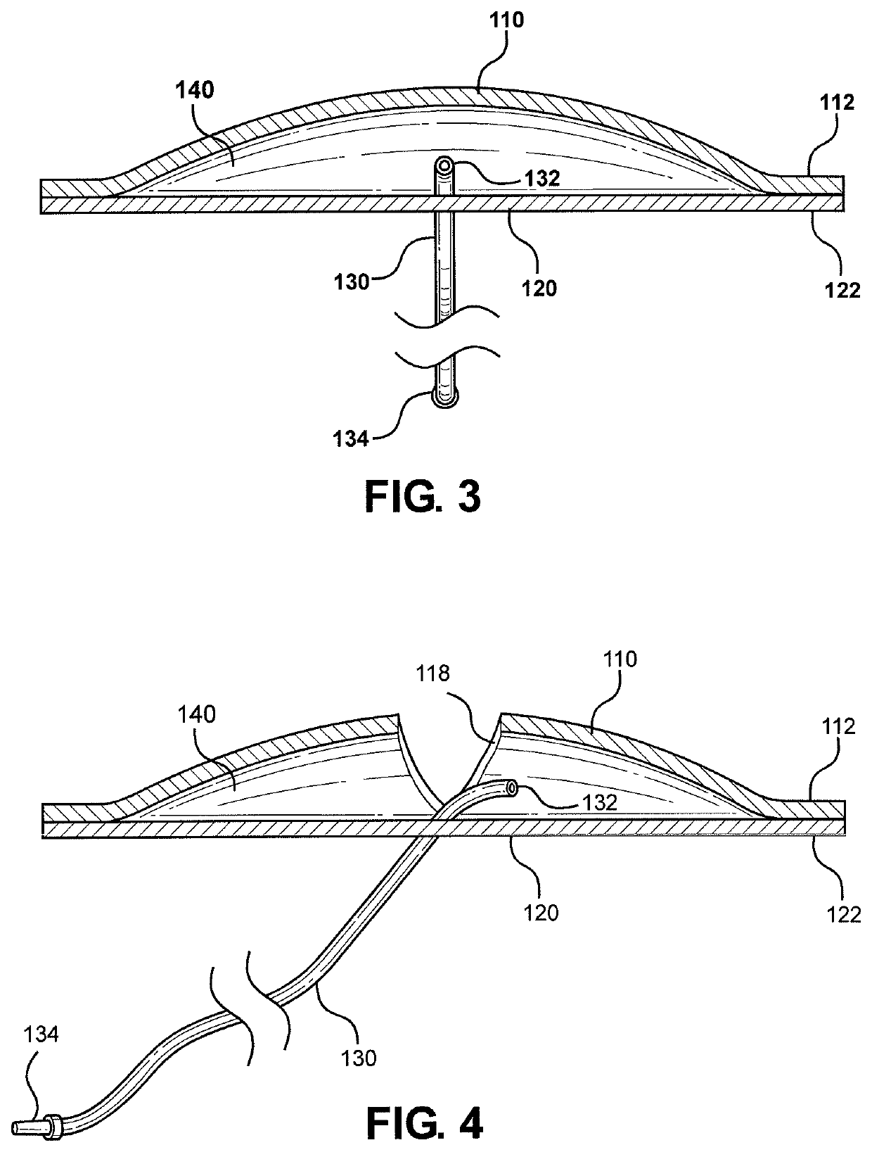 Multi-junctional bleeding simulator