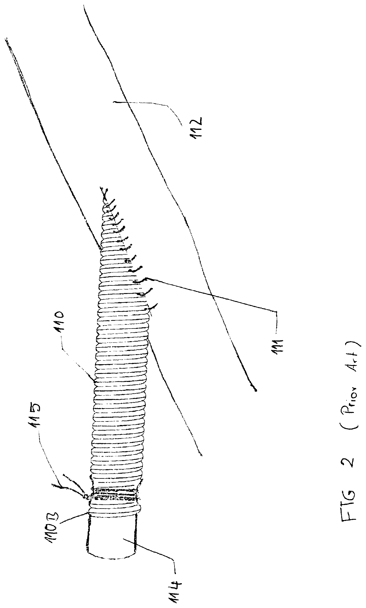 Vascular access