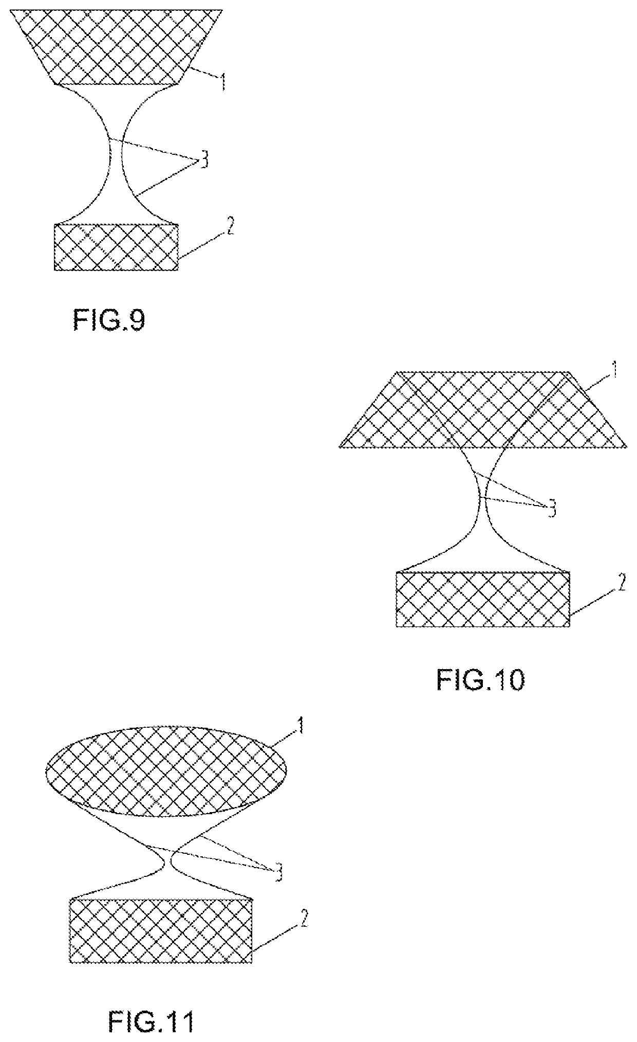 Gastric diverter and digestive tract support and release method thereof