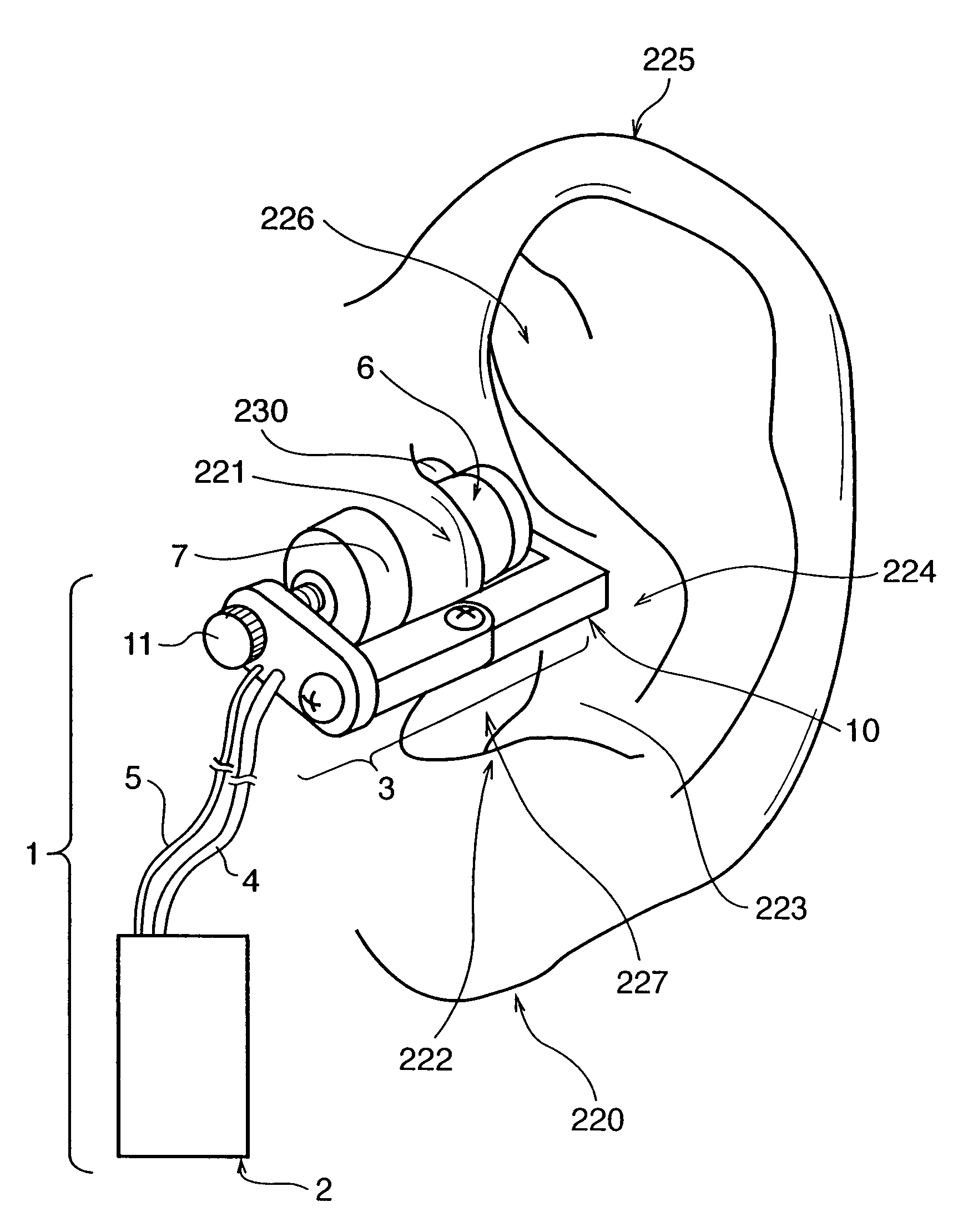 Blood pressure measuring apparatus