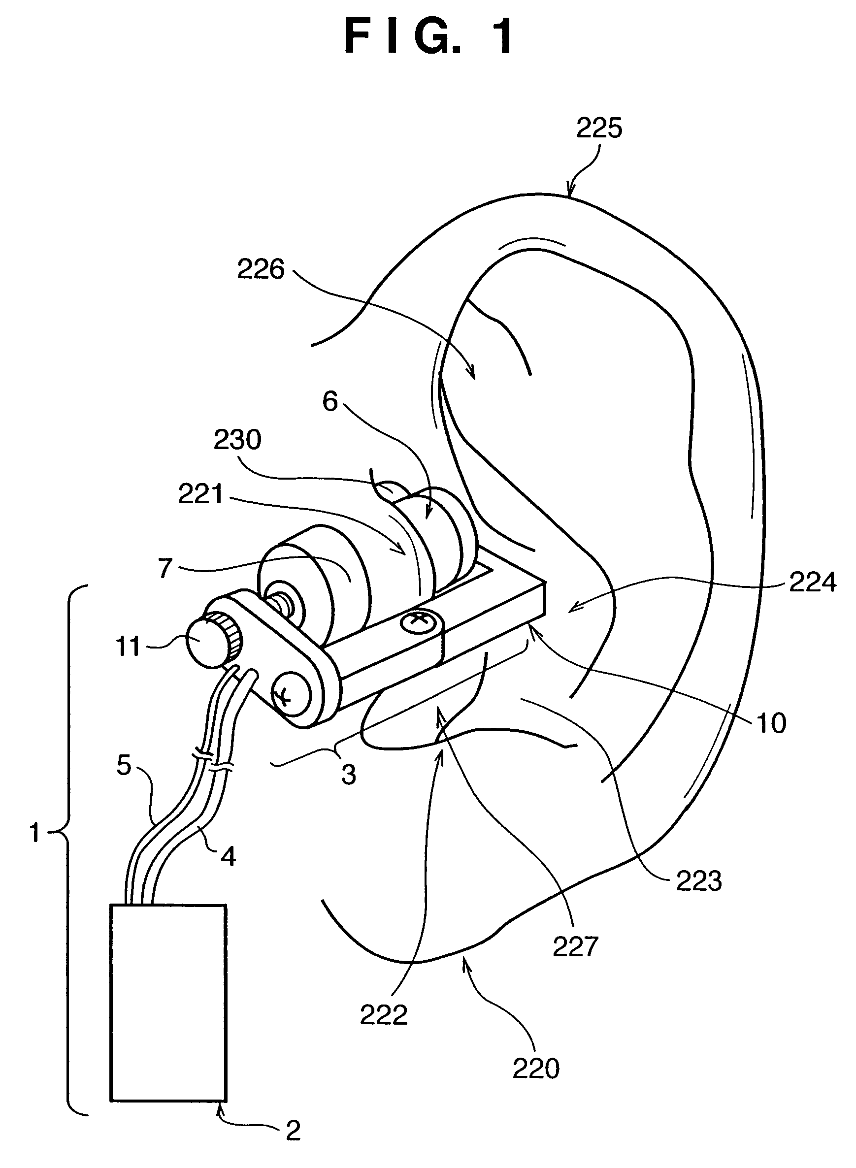 Blood pressure measuring apparatus