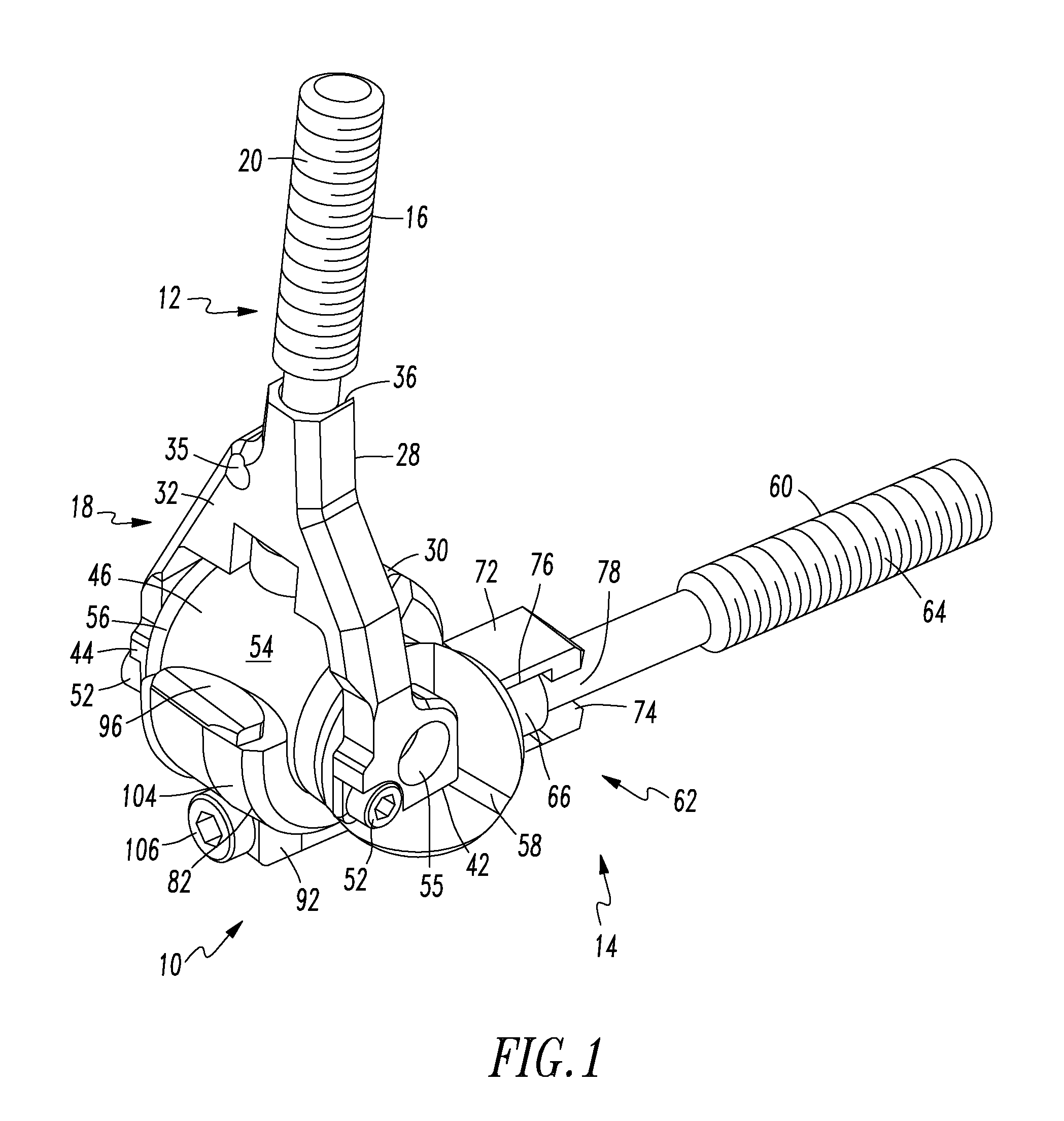 Prosthesis for Partial and Total Joint Replacement