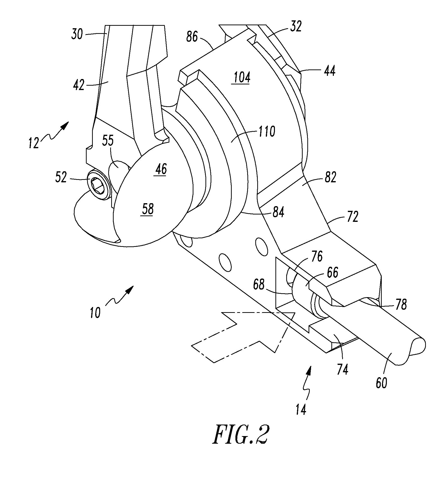 Prosthesis for Partial and Total Joint Replacement