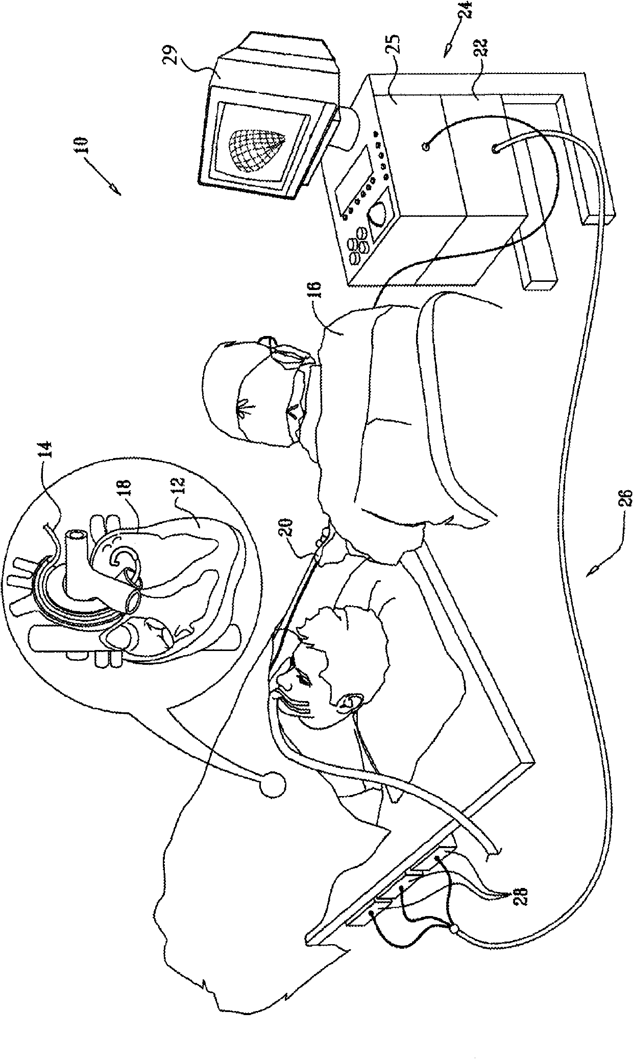 Dual-purpose lasso catheter with irrigation